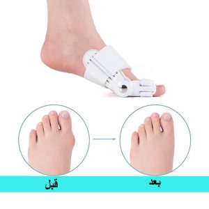 اصلاح کننده انحراف شست پا کد 6118
