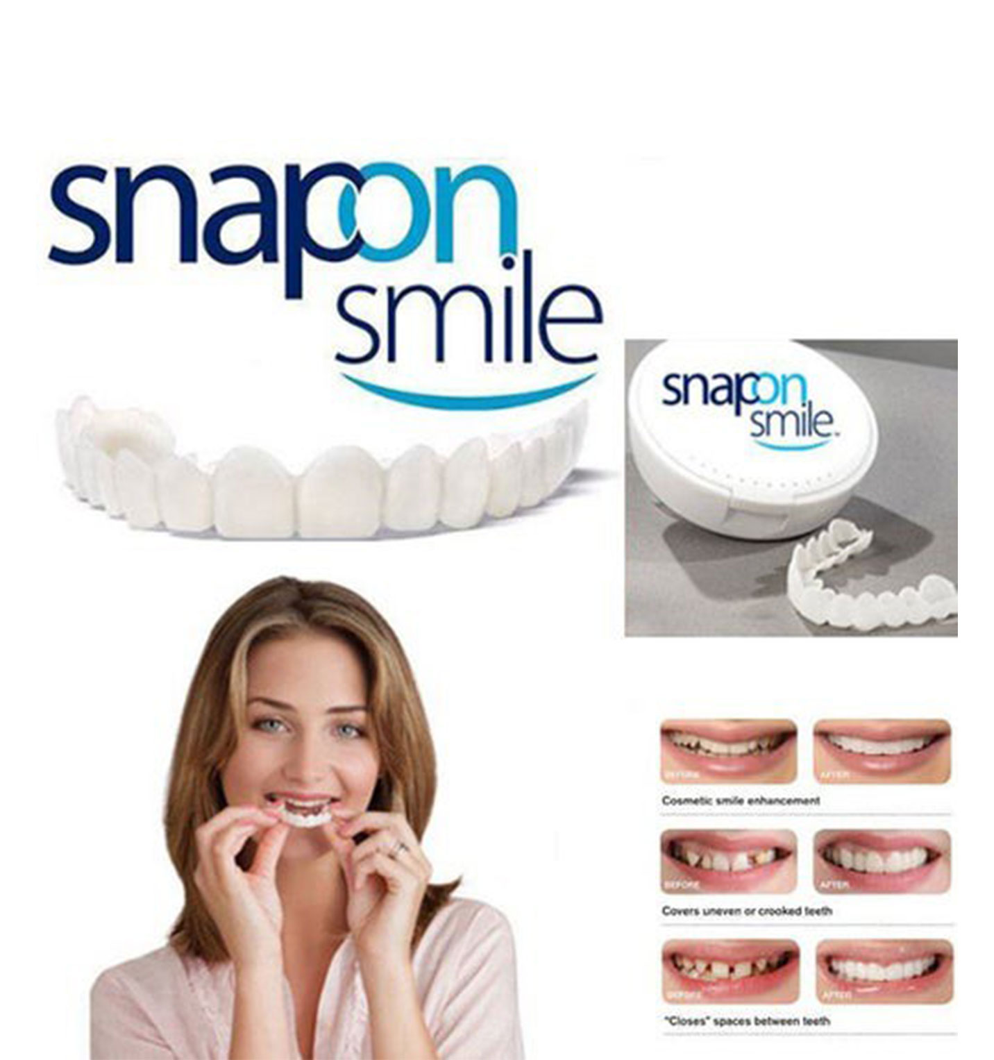 لمینت دندان Snap – On Smile مدل 41306