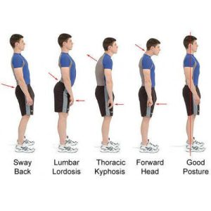 رفع قوز شانه Royal Posture