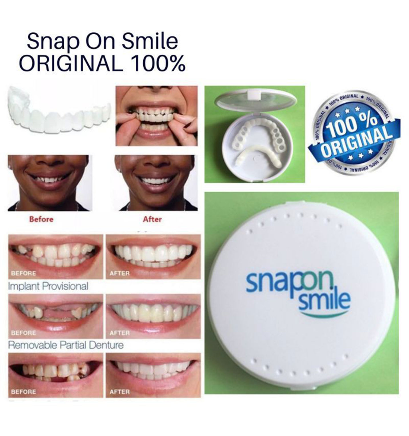 لمینت دندان Snap – On Smile مدل 41306