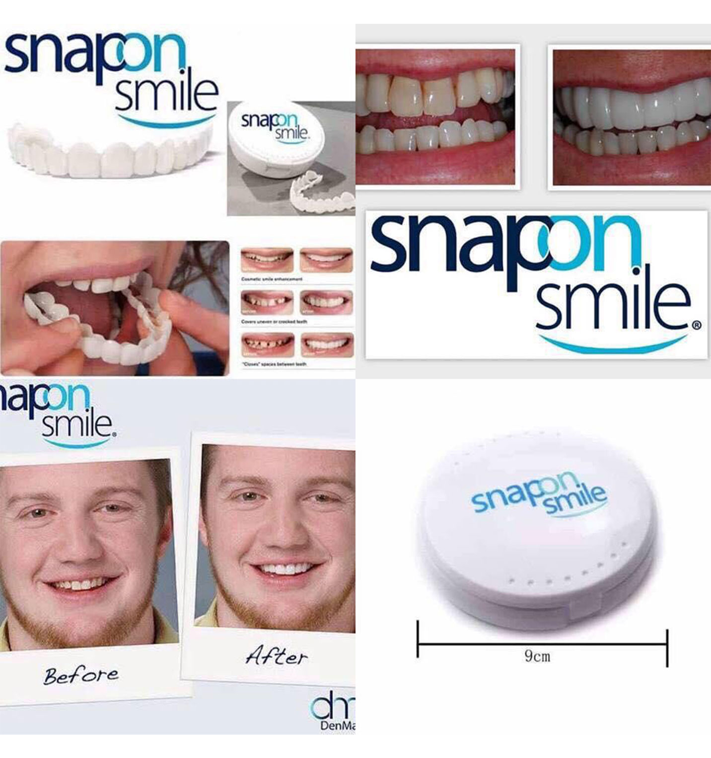 لمینت دندان Snap – On Smile مدل 41306