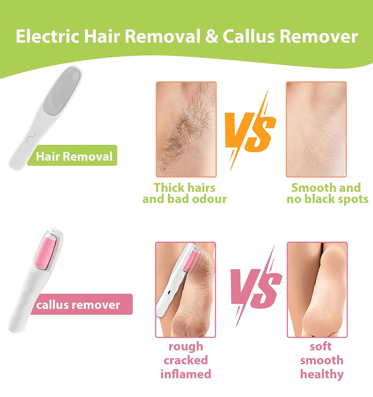 دستگاه دو کاره سنگ پا موبر شارژی مدل 47852