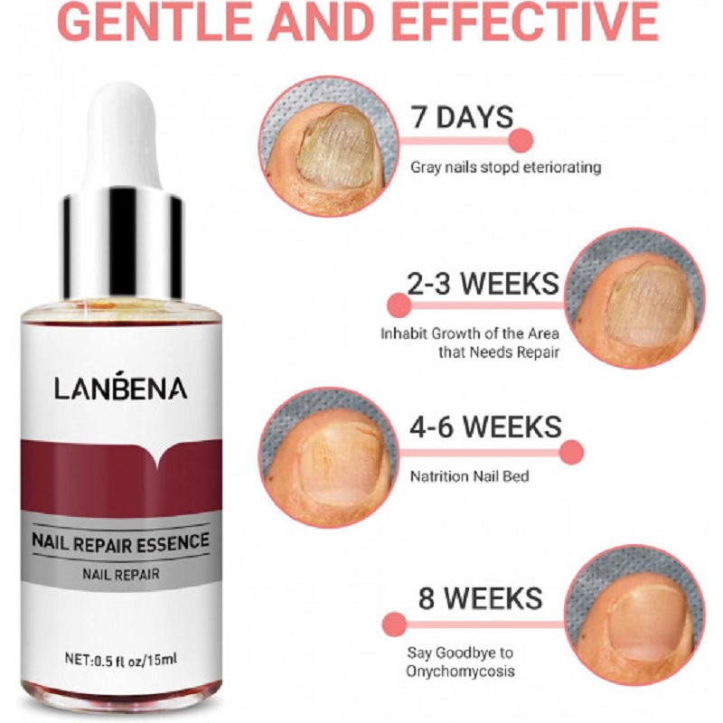 سرم تقویت کننده ناخن مدل LANBENA چند رنگ