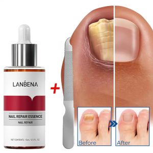 سرم تقویت کننده ناخن مدل LANBENA چند رنگ
