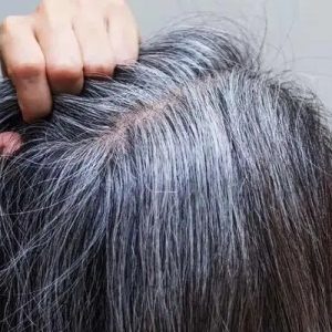 روش علمی برای به تاخیر انداختن سفیدی موها