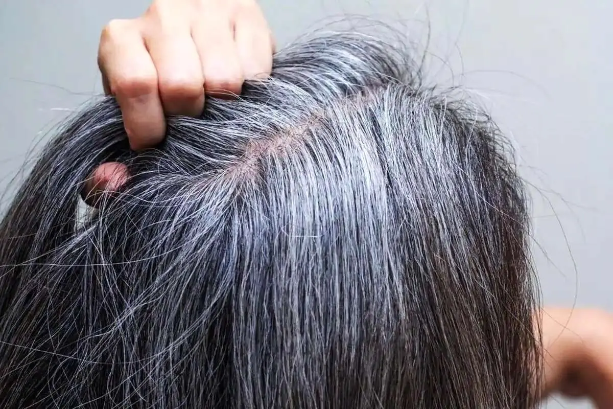 6 روش علمی برای به تاخیر انداختن سفیدی موها