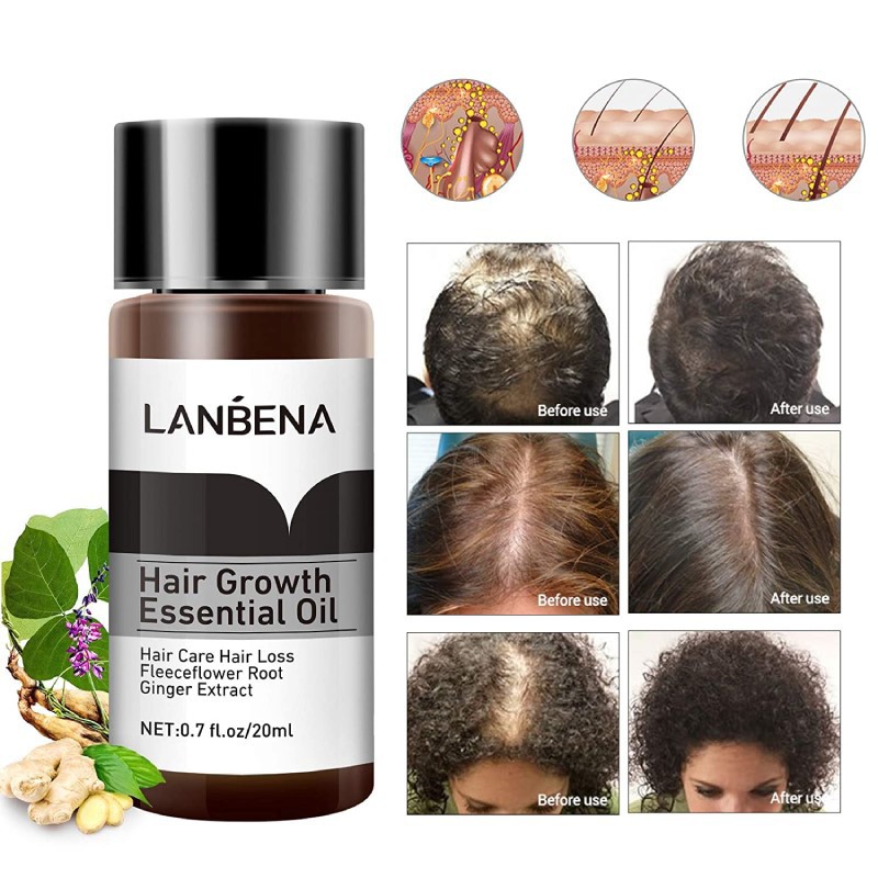 روغن رشد مو لانبنا LANBENA