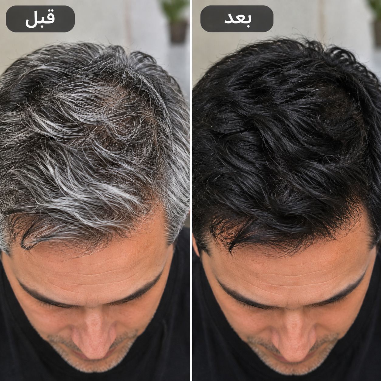 پکیج ماساژور سر smart scalp مناسب رشد مو شامپو رنگ مو بابل موس پک اورجینال تستردار