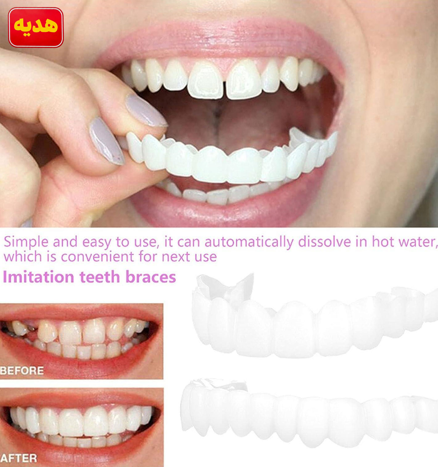 پک مسواک شارژی لمینت دندان snap on smile مدل 51716